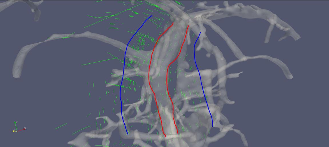 9) BSLIVE / Tissue Addon Streamlines Infection Curves VFX